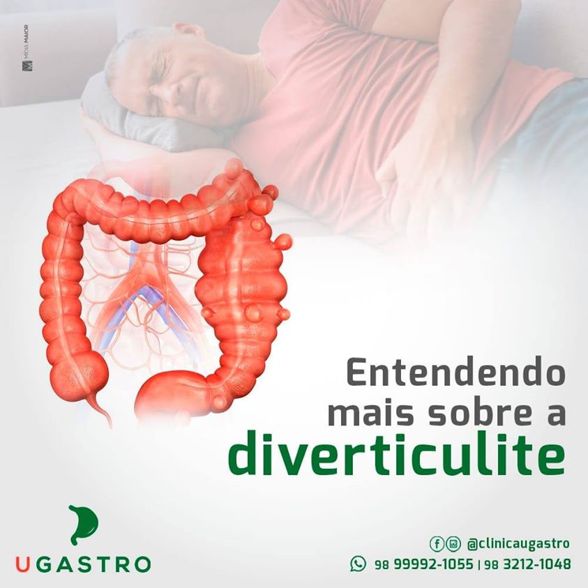 Entendendo mais sobre a diverticulite Ugastro Entendendo mais sobre a diverticulite Ugastro